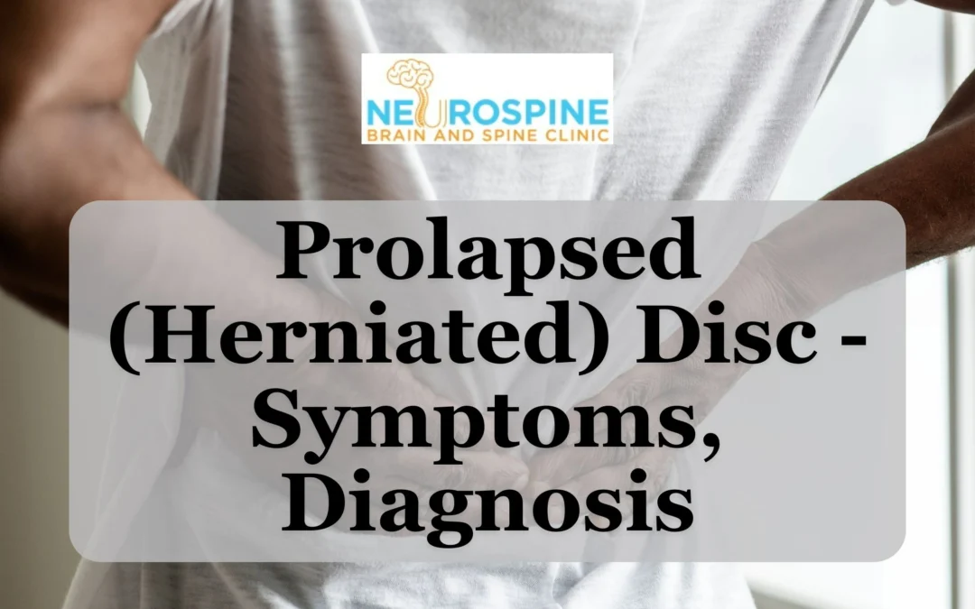 Prolapsed (Herniated) Disc – Symptoms, Diagnosis
