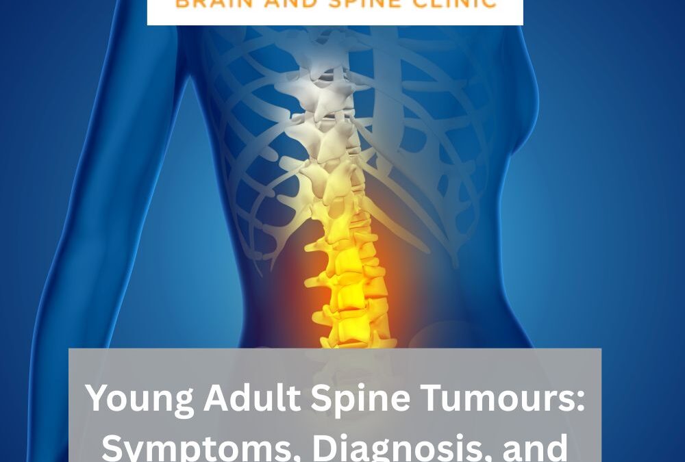 Young Adult Spine Tumours: Symptoms, Diagnosis, and Treatment
