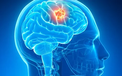 Understanding Brain Tumors