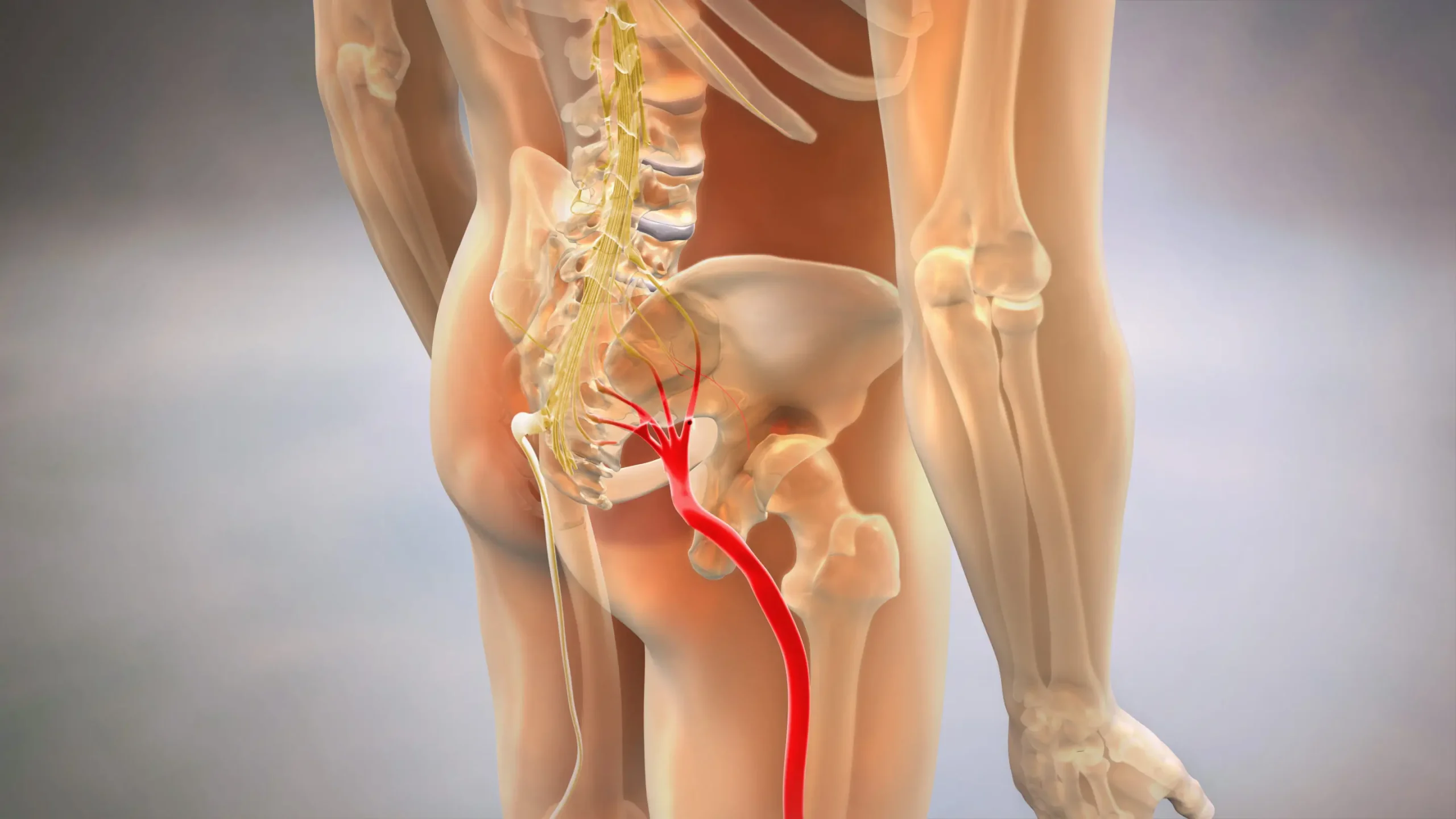 Slipped Disc vs Sciatica