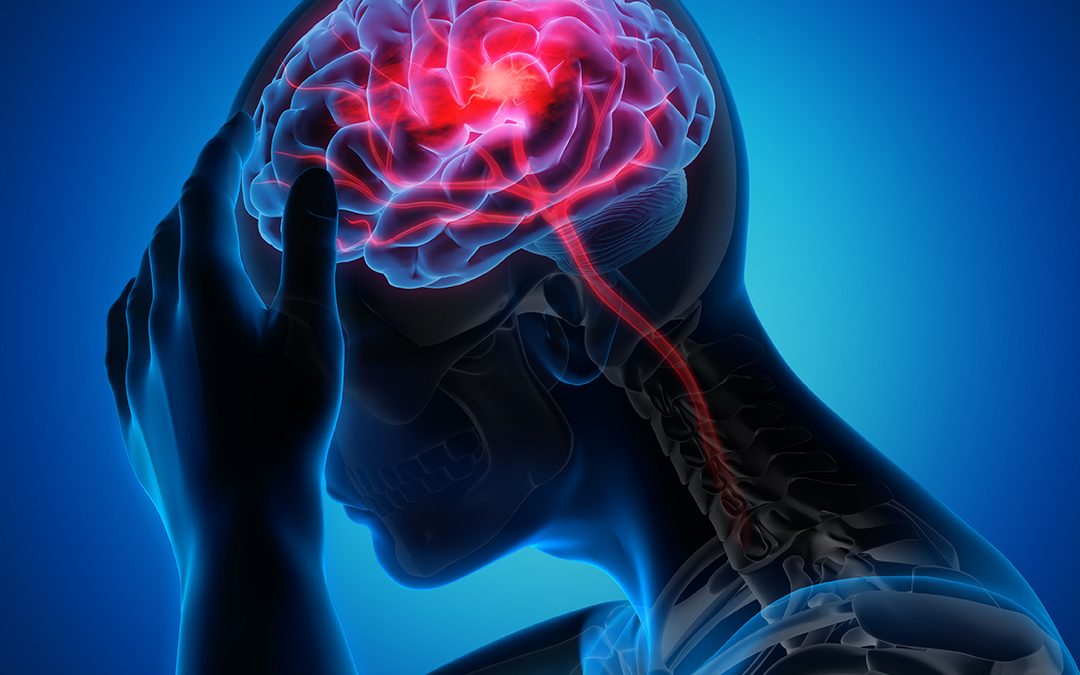 Stroke Recovery & Neurosurgical Care