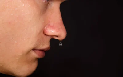 Water Dripping From the Nose for 3 Months